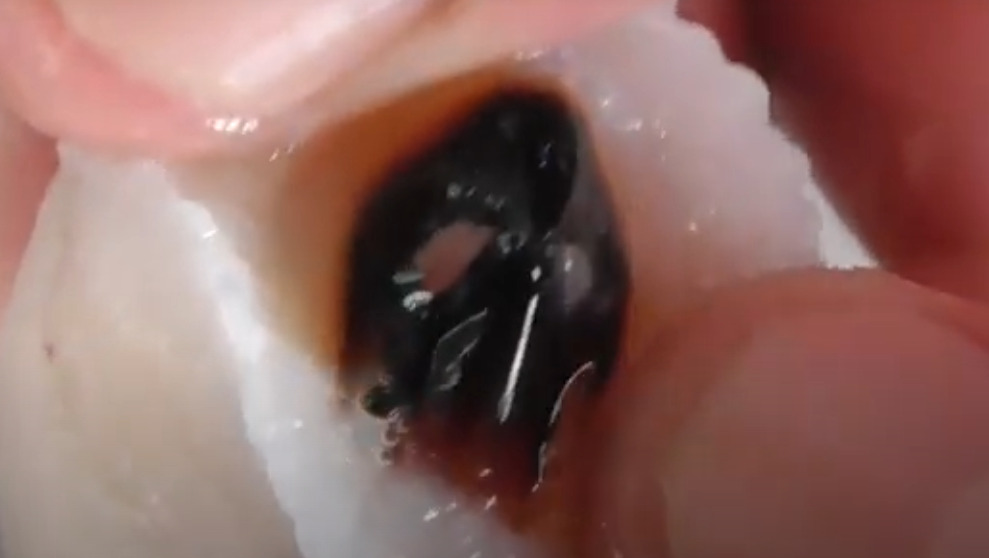 イカの口はイカトンビ、カラストンビ、タコトンビとも呼ばれ、鳥のくちばしのような形で非常に強固。骨もかみ砕くほど強烈な力がある。これは成長の原動力。釣太郎