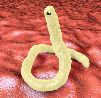 天然魚には寄生虫が多いが、魚種ごとに変わるのは、食べているものが違うから。釣太郎