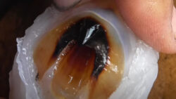 イカトンビ。アオリイカの歯は魚の骨をかみ砕く程鋭く強力で危険。でも旨い部位。釣太郎