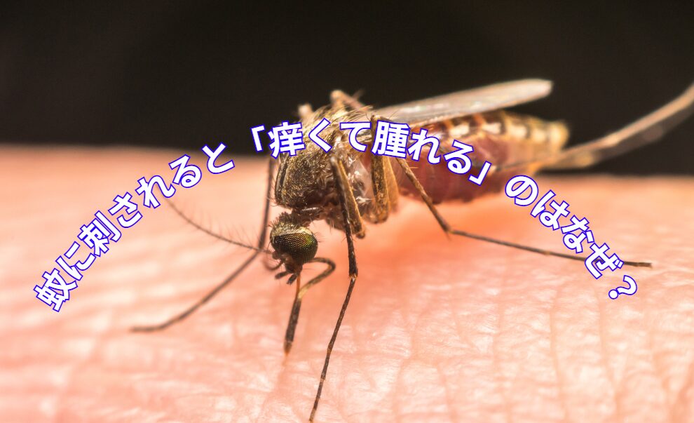 蚊に刺されると「痒くて腫れる」理由説明。釣太郎