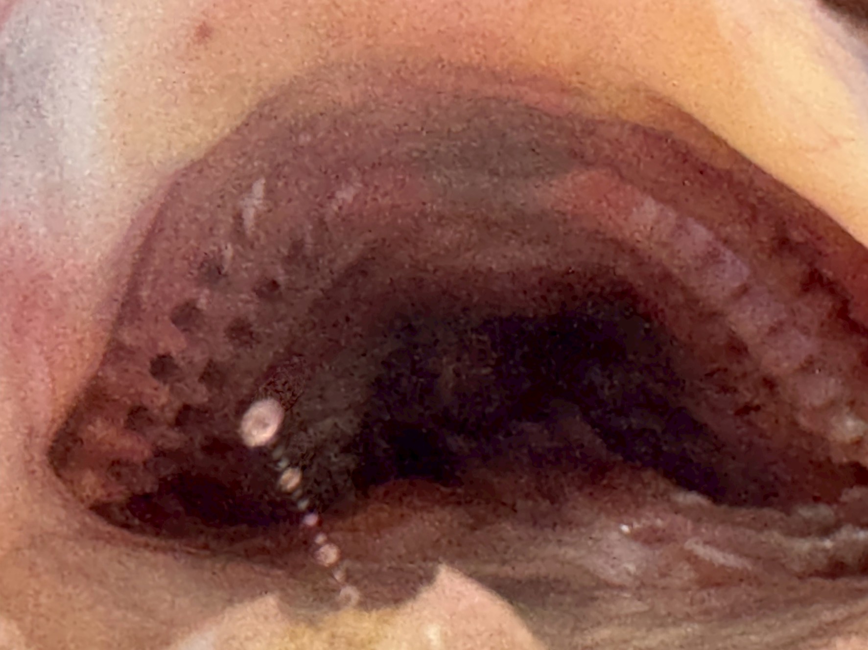 【衝撃画像あり】マゴチの口の中を徹底解剖!鋭い歯と奥深い生態の秘密とは?釣太郎