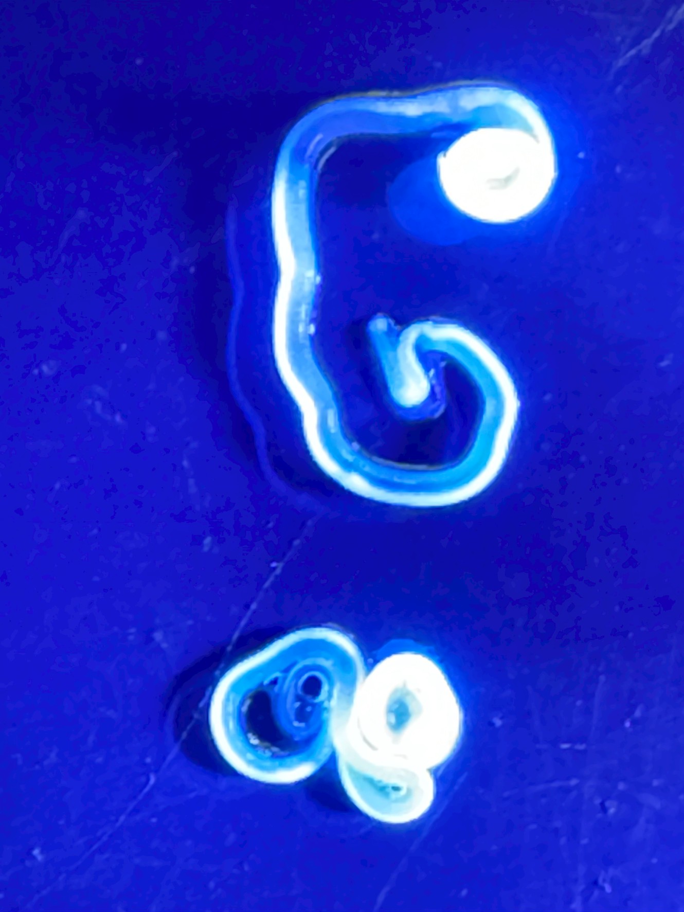 アニサキス、気づかず生きたまま人間の胃袋に入れてしまうと、強酸性の胃液から逃れようと胃壁や腸壁を突き破ろうと猛烈に噛み付いてきます。釣太郎